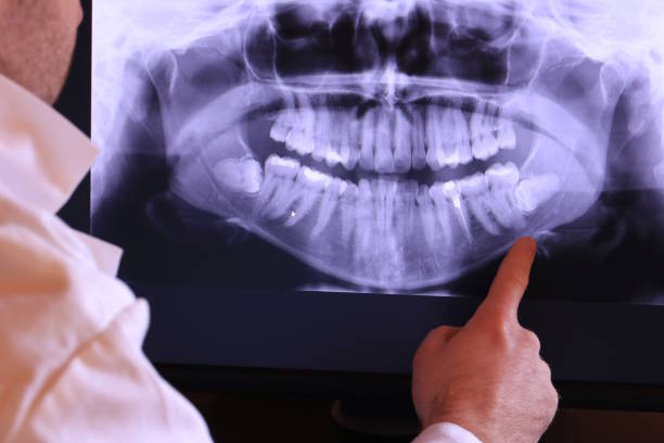 Best Dentist for Tooth Abscess  in Hudson, TX